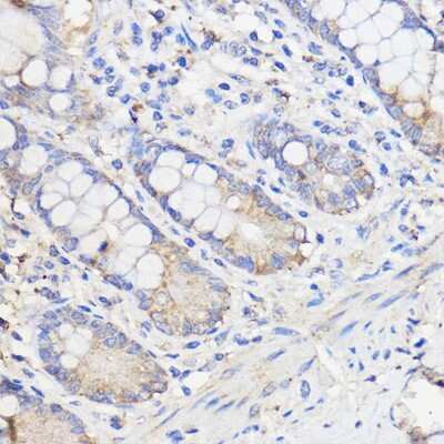 Immunohistochemistry-Paraffin: WBSCR27 Antibody - Azide and BSA Free [NBP2-93973]