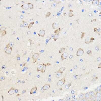 Immunohistochemistry-Paraffin: WBSCR27 Antibody - Azide and BSA Free [NBP2-93973]