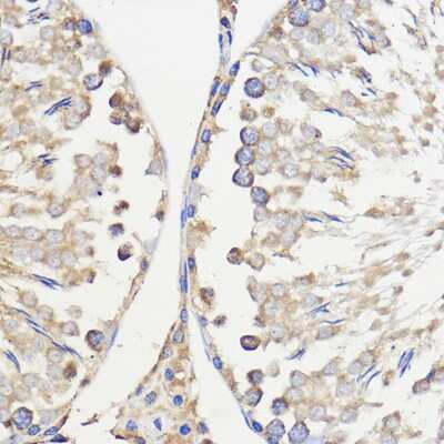 Immunohistochemistry-Paraffin: WBSCR27 Antibody - Azide and BSA Free [NBP2-93973]