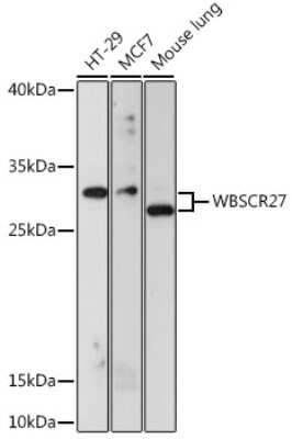 Western Blot: WBSCR27 AntibodyAzide and BSA Free [NBP2-93973]