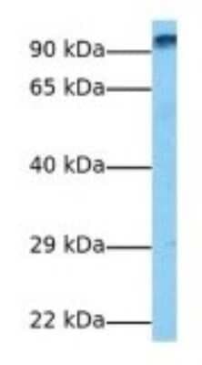 Western Blot: WDFY3 Antibody [NBP3-09287]