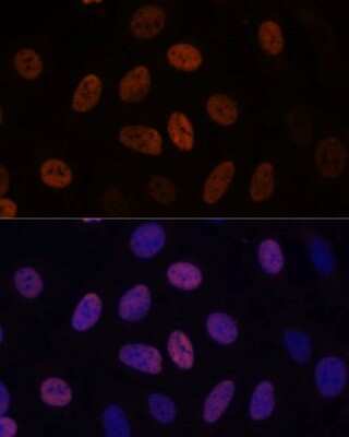 Immunocytochemistry/ Immunofluorescence: WDHD1 Antibody - Azide and BSA Free [NBP2-93674]