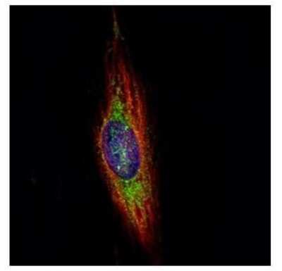 Immunocytochemistry/ Immunofluorescence: WDR16 Antibody [NBP2-20889]