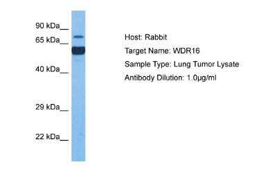 Western Blot: WDR16 Antibody [NBP2-88588]