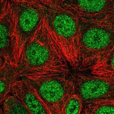 Immunocytochemistry/ Immunofluorescence: WDR18 Antibody [NBP2-30928]