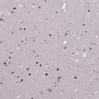 Immunohistochemistry-Paraffin: WDR18 Antibody [NBP2-30928]