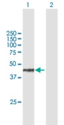 Western Blot: WDR18 Antibody [H00057418-B01P]