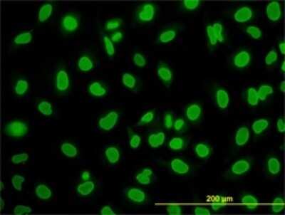 Immunocytochemistry/ Immunofluorescence: WDR20 Antibody (2A6) [H00091833-M02]