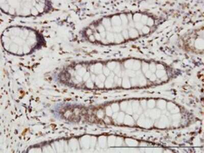 Immunohistochemistry-Paraffin: WDR20 Antibody (2A6) [H00091833-M02]