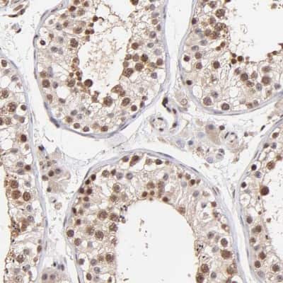 Immunohistochemistry-Paraffin: WDR25 Antibody [NBP1-93467]