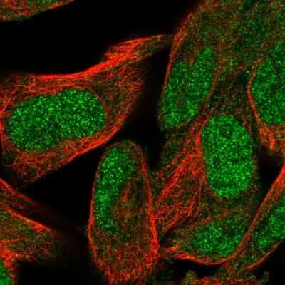 Immunocytochemistry/ Immunofluorescence: WDR26 Antibody [NBP2-56688]