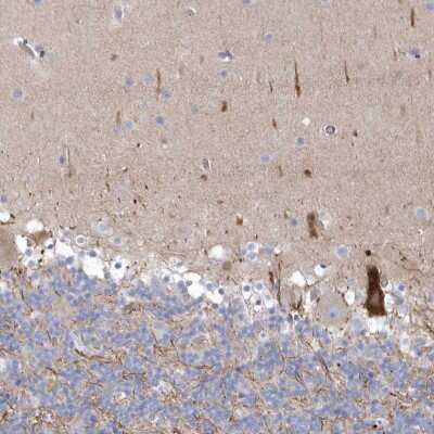 Immunohistochemistry: WDR27 Antibody [NBP2-38349]