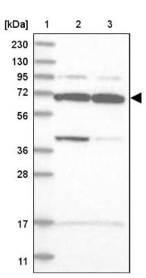 Western Blot: WDR27 Antibody [NBP1-81075]