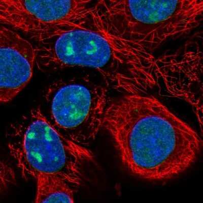 Immunocytochemistry/ Immunofluorescence: WDR3 Antibody [NBP1-82281]