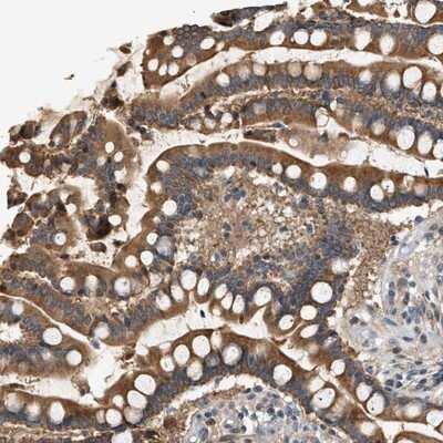 Immunohistochemistry-Paraffin: WDR31 Antibody [NBP1-81962]