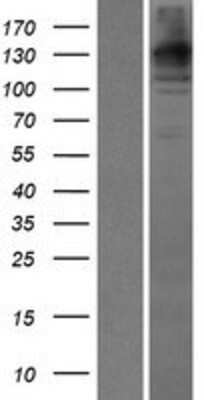 Western Blot: WDR35 Overexpression Lysate [NBP2-06614]