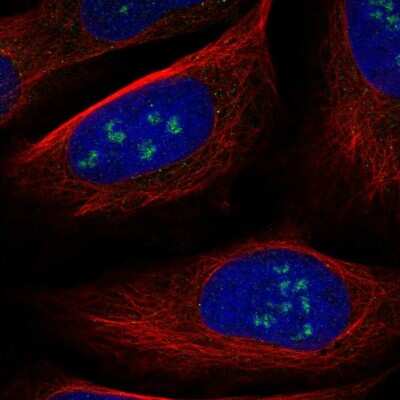 Immunocytochemistry/ Immunofluorescence: WDR36 Antibody [NBP2-38364]