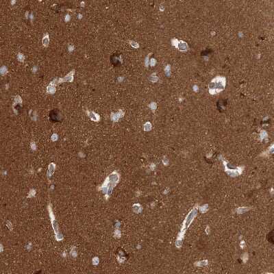 Immunohistochemistry-Paraffin: WDR37 Antibody [NBP1-81449]