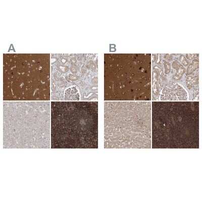 Immunohistochemistry-Paraffin: WDR37 Antibody [NBP1-81449]