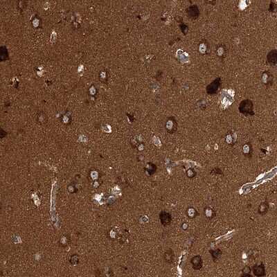Immunohistochemistry-Paraffin: WDR37 Antibody [NBP1-81450]