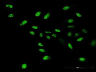 Immunocytochemistry/ Immunofluorescence: WDR4 Antibody [H00010785-D01P]