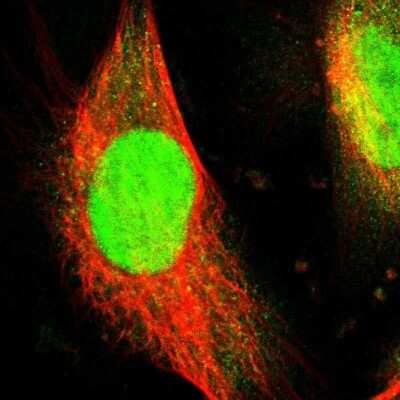 Immunocytochemistry/ Immunofluorescence: WDR4 Antibody [NBP1-86901]