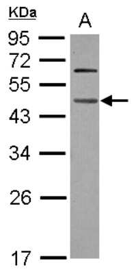 Western Blot: WDR4 Antibody [NBP2-20893]