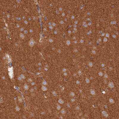 Immunohistochemistry-Paraffin: WDR41 Antibody [NBP1-83812]