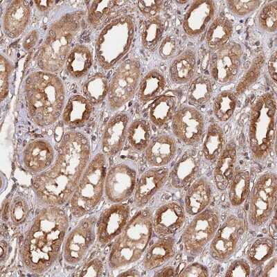 Immunohistochemistry-Paraffin: WDR41 Antibody [NBP1-83812]