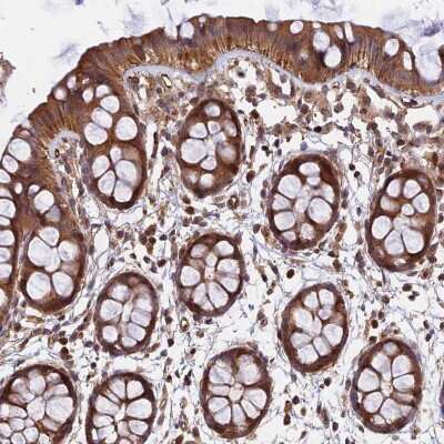 Immunohistochemistry-Paraffin: WDR41 Antibody [NBP1-83812]