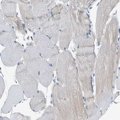 Immunohistochemistry-Paraffin: WDR51A Antibody [NBP1-88008]