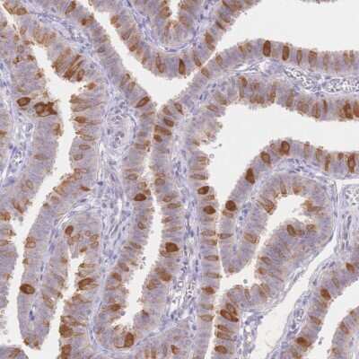 Immunohistochemistry: WDR54 Antibody [NBP2-38705]