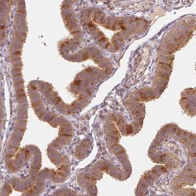 Immunohistochemistry-Paraffin: WDR54 Antibody [NBP1-82275]