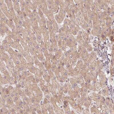 Immunohistochemistry-Paraffin: WDR54 Antibody [NBP1-82275]