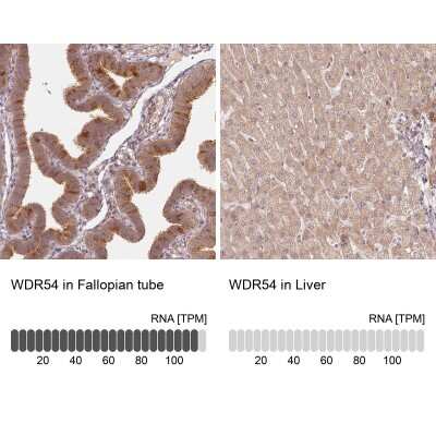 Immunohistochemistry-Paraffin: WDR54 Antibody [NBP1-82275]