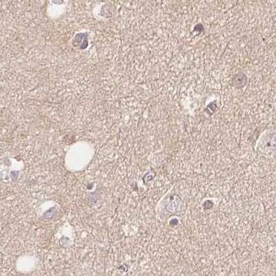 Immunohistochemistry-Paraffin: WDR54 Antibody [NBP1-82275]