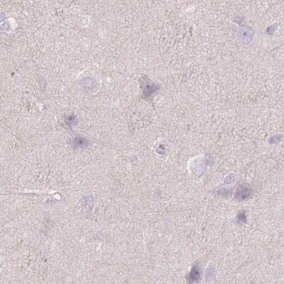 Immunohistochemistry-Paraffin: WDR54 Antibody [NBP2-38705]