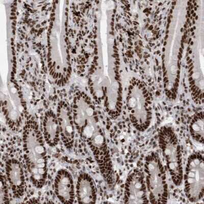 Immunohistochemistry-Paraffin: WDR57 Antibody [NBP1-92585]