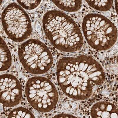 Immunohistochemistry-Paraffin: WDR57 Antibody [NBP1-92586]