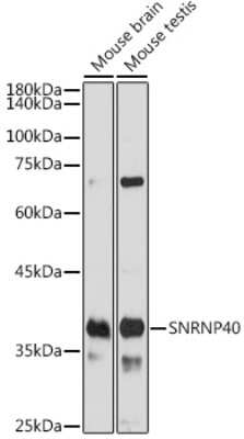 Western Blot: WDR57 AntibodyAzide and BSA Free [NBP3-15611]