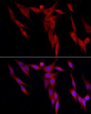 Immunocytochemistry/ Immunofluorescence: WDR6 Antibody - Azide and BSA Free [NBP2-93695]