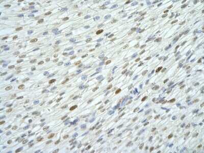 Immunohistochemistry: WDR6 Antibody [NBP1-54844]