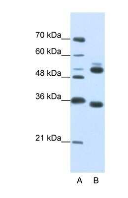 Western Blot: WDR6 Antibody [NBP1-54844]