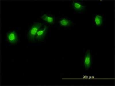 Immunocytochemistry/ Immunofluorescence: WDR61 Antibody (3E5-1A12) [H00080349-M01]