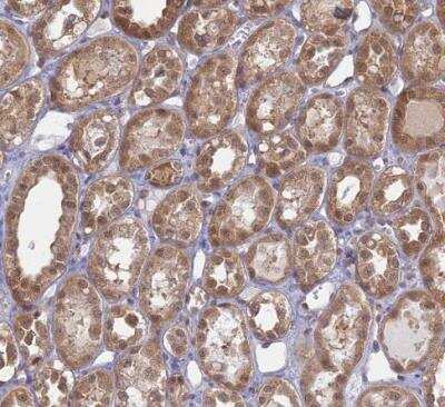Immunohistochemistry-Paraffin: WDR61 Antibody [NBP1-80844]