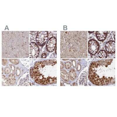 Immunohistochemistry-Paraffin: WDR61 Antibody [NBP1-80845]