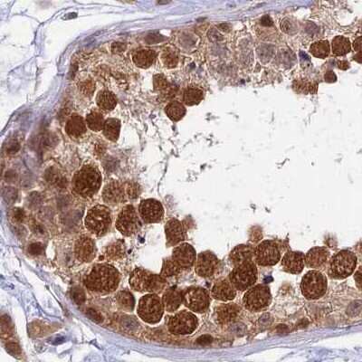 Immunohistochemistry-Paraffin: WDR61 Antibody [NBP1-80845]