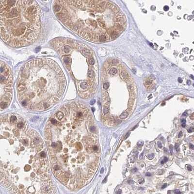 Immunohistochemistry-Paraffin: WDR61 Antibody [NBP1-80845]