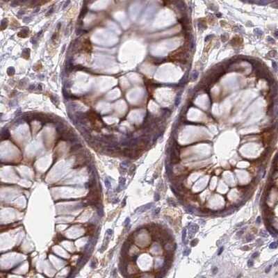 Immunohistochemistry-Paraffin: WDR61 Antibody [NBP1-80845]