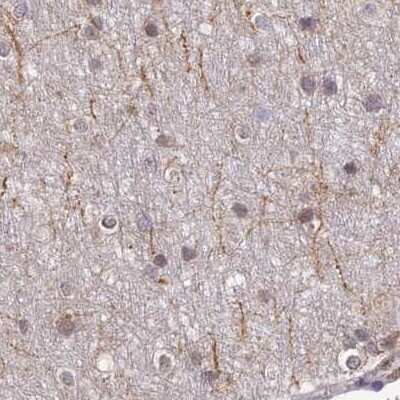 Immunohistochemistry-Paraffin: WDR61 Antibody [NBP1-80845]